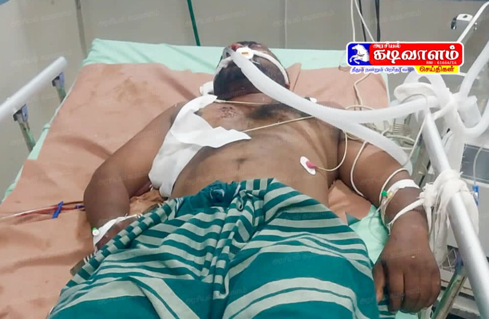 தூத்துக்குடியில் அடையாளம் தெரியாத கார் மோதி பாரத் பெட்ரோலியம் ஓட்டுநர் படுகாயம் - ஆபத்தான நிலையில் தீவிர சிகிச்சை.!.
